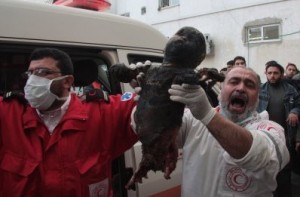 8 janvier 2009, Gaza: enfant brulé au phosphore blanc. (Photo: Fady Awan)